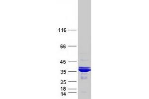 Validation with Western Blot
