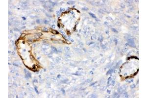 IHC analysis of IDO1 using anti-IDO1 antibody (ABIN3043857).