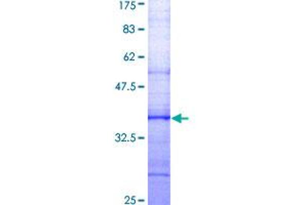 SLC9A1 Protein (AA 31-130) (GST tag)