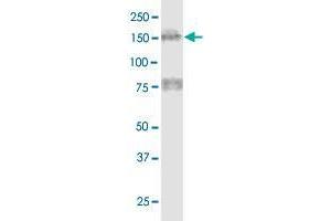 Western Blotting (WB) image for anti-Microtubule Associated Tumor Suppressor 1 (MTUS1) (AA 1-240) antibody (ABIN566122)