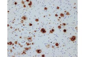 Immunostaining of paraffin embedded sections from an Alzheimer's patient (dilution 1 : 200). (Abeta-pE3 Antikörper)