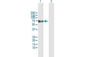 Western Blot analysis of KLHDC4 expression in transfected 293T cell line by KLHDC4 MaxPab polyclonal antibody. (KLHDC4 Antikörper  (AA 1-520))