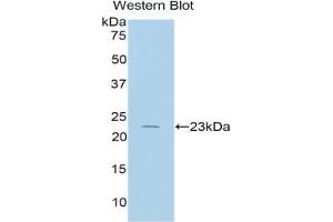 Western blot analysis of the recombinant protein. (IL17 Receptor B Antikörper  (AA 166-354))