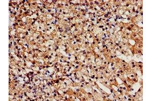 Immunohistochemistry analysis of human adrenal gland tissue using ABIN7171654 at dilution of 1:100 (TBC1D4 Antikörper  (AA 1-94))