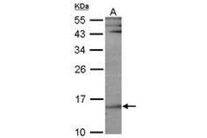 Image no. 1 for anti-Ubiquitin-Conjugating Enzyme E2B (UBE2B) (AA 7-152) antibody (ABIN467405) (UBE2B Antikörper  (AA 7-152))