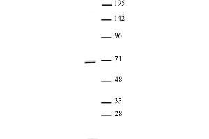 Western Blotting (WB) image for anti-Protein Phosphatase, Mg2+/Mn2+ Dependent, 1D (PPM1D) (C-Term) antibody (ABIN6972548)