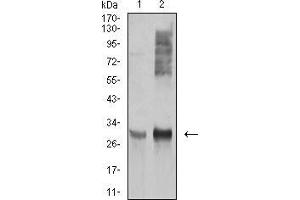 Western blot analysis using HLA-DRA mouse mAb against Ramos (1), and Raji (2) cell lysate. (HLA-DRA Antikörper  (AA 26-254))