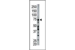 ACSL6 Antikörper  (AA 240-270)