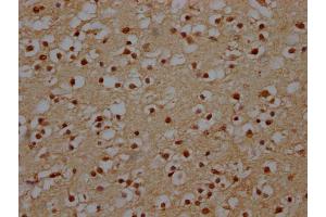 IHC image of ABIN7151088 diluted at 1:140 and staining in paraffin-embedded human brain tissue performed on a Leica BondTM system. (NHLRC1 Antikörper  (AA 86-395))