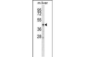 Western blot analysis in mouse liver tissue lysates (35ug/lane). (ZDHHC6 Antikörper  (C-Term))