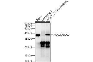 Immunoprecipitation analysis of 600 μg extracts of Mouse liver cells using 3 μg ACADS / SCAD antibody (ABIN7265419). (ACADS Antikörper)