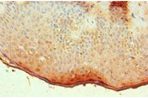 Immunohistochemistry of paraffin-embedded human skin tissue using ABIN7144533 at dilution of 1:100 (ALOX15B Antikörper  (AA 1-200))