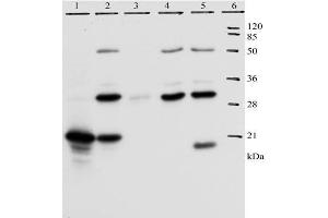 IP analysis of HPV-18 E7 protein. (HPV18 E7 Antikörper  (AA 36-70))