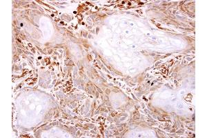 IHC-P Image VPS11 antibody detects VPS11 protein at cytosol on Ca922 xenograft by immunohistochemical analysis.