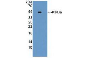 Figure. (WNK1 Antikörper  (AA 1954-2231))