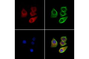 ABIN7094449 and ABIN7098497 staining Hela cells by IF/ICC.