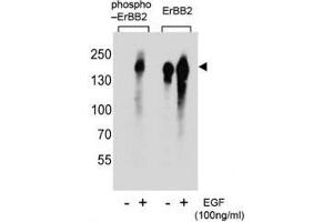 Western blot analysis of extracts from A431 cells, untreated or treated with EGF, using phospho-ERBB2 antibody (left) or nonphos Ab (right). (ErbB2/Her2 Antikörper  (pTyr1005))