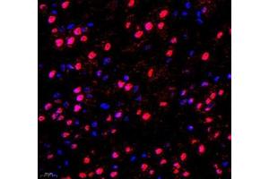 Immunofluorescence of paraffin embedded mouse brain using DMRTA2 (ABIN7073753) at dilution of 1: 650 (400x lens) (DMRTA2 Antikörper)