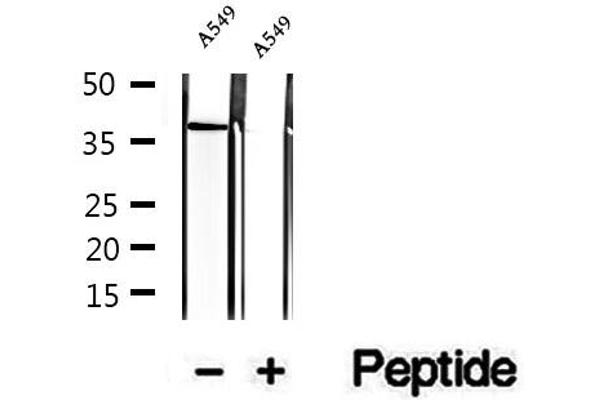 STBD1 Antikörper  (N-Term)