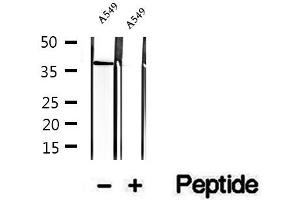 Western blot analysis of extracts of A549 cells, using STBD1 antibody. (STBD1 Antikörper  (N-Term))