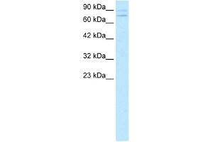 WB Suggested Anti-ZNF81 Antibody Titration:  0. (ZNF81 Antikörper  (Middle Region))