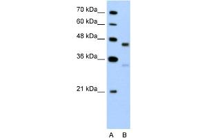 WB Suggested Anti-GPR161 Antibody Titration:  5. (GPR161 Antikörper  (C-Term))