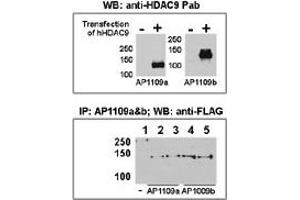 Both anti-HDAC9 N-term ((ABIN387960 and ABIN2844679)) and C-term ((ABIN387961 and ABIN2844680)) Pab were tested by WB and IP-WB using HeLa and HeLa-HDAC9 transfected cells. (HDAC9 Antikörper  (C-Term))