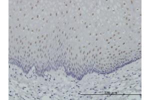 Immunoperoxidase of monoclonal antibody to RARA on formalin-fixed paraffin-embedded human esophagus. (Retinoic Acid Receptor alpha Antikörper  (AA 315-424))