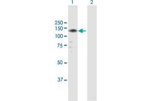Western Blot analysis of LLGL2 expression in transfected 293T cell line by LLGL2 MaxPab polyclonal antibody. (LLGL2 Antikörper  (AA 1-1020))