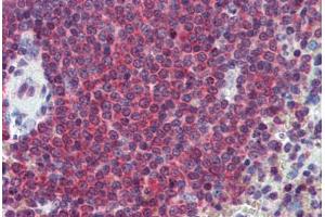 Human Spleen: Formalin-Fixed, Paraffin-Embedded (FFPE) (CA1 Antikörper  (AA 166-176))