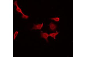 ABIN6274482 staining Hela by IF/ICC. (CIB3 Antikörper  (C-Term))