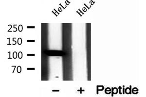 Western blot analysis of extracts of HeLa cells, using IPO4 antibody. (Importin 4 Antikörper  (Internal Region))