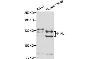 Western blot analysis of extracts of A549 and mouse kidney cell lines, using NINL antibody. (NINL Antikörper)