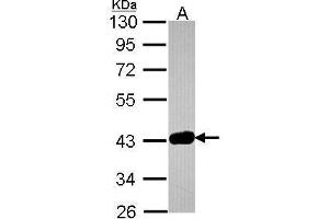WB Image Sample (30 ug of whole cell lysate) A: JurKat 10% SDS PAGE antibody diluted at 1:1000 (GRAP2 Antikörper)