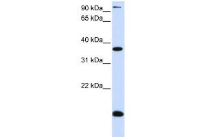 WB Suggested Anti-KLF8 Antibody Titration: 0. (KLF8 Antikörper  (N-Term))
