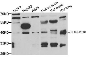 Western blot analysis of extracts of various cell lines, using ZDHHC16 antibody. (ZDHHC16 Antikörper)
