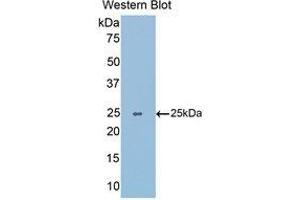 Western Blotting (WB) image for anti-Slit Homolog 1 (SLIT1) (AA 3-211) antibody (ABIN1176119) (SLIT1 Antikörper  (AA 3-211))