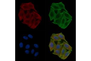 ABIN6266193 and ABIN6277347 staining Hela cells(30 min of UV treatment) by IF/ICC. (CPT2 Antikörper  (Internal Region))