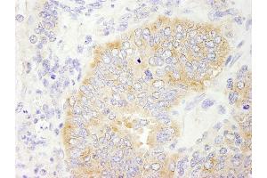 Immunohistochemistry (IHC) image for anti-eIF2beta/EIF2S2 (AA 283-333) antibody (ABIN7448545) (eIF2beta/EIF2S2 (AA 283-333) Antikörper)