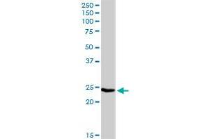 IGLL1 MaxPab rabbit polyclonal antibody. (IGLL1 Antikörper  (AA 1-213))