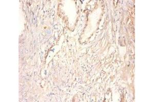Immunohistochemistry of paraffin-embedded human prostate tissue using ABIN7148667 at dilution of 1:100 (CKMT1A Antikörper  (AA 40-417))