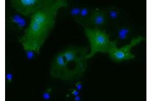 Anti-MOBKL2B mouse monoclonal antibody (ABIN2453319) immunofluorescent staining of COS7 cells transiently transfected by pCMV6-ENTRY MOBKL2B (RC205977). (MOBKL2B Antikörper)