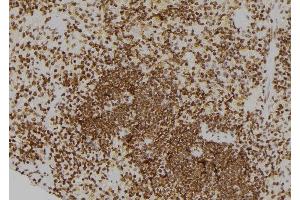 ABIN6276576 at 1/100 staining Rat spleen tissue by IHC-P.