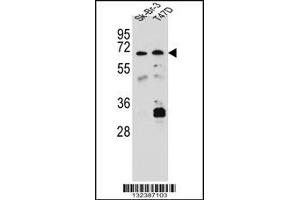 Western blot analysis in Sk-Br-3,T47D cell line lysates (35ug/lane). (CES4A Antikörper  (C-Term))