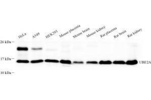 Western blot analysis of UBE2A (ABIN7075356) at dilution of 1: 500 (Rad6 Antikörper)