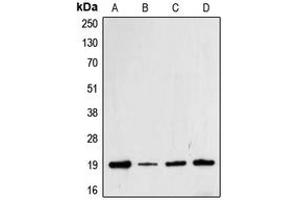 Western blot analysis of Cofilin (pS3) expression in Jurkat (A), HeLa (B), MCF7 (C), A431 (D) whole cell lysates. (Cofilin Antikörper  (N-Term, pSer3))