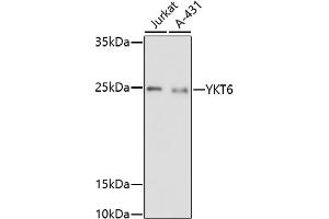 Western blot analysis of extracts of various cell lines, using YKT6 antibody (ABIN7271424) at 1:1000 dilution. (YKT6 Antikörper)