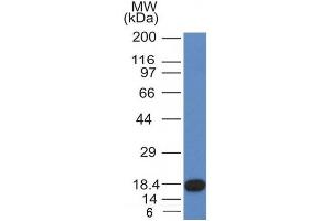 Image no. 1 for anti-Mast/stem Cell Growth Factor Receptor (KIT) (AA 100-300) antibody (ABIN6190751) (KIT Antikörper  (AA 100-300))