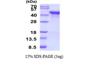 SDS-PAGE (SDS) image for Matrix Metallopeptidase 1 (Interstitial Collagenase) (MMP1) (AA 100-469) protein (His tag) (ABIN5853523)