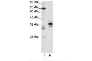 Image no. 1 for anti-Paired-Like Homeodomain 1 (PITX1) (C-Term) antibody (ABIN202221) (PITX1 Antikörper  (C-Term))